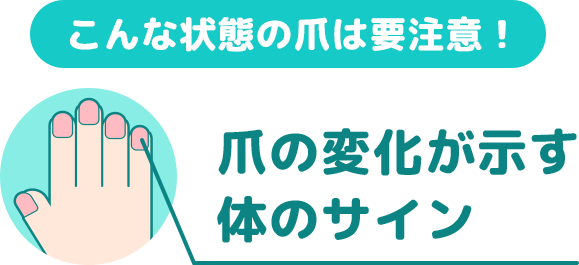 こんな状態の爪は要注意! 爪の変化が示す体のサイン