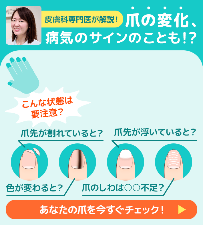 皮膚科専門医が解説！ 爪の変化、病気のサインのことも！？ こんな状態は要注意？ 爪先が割れていると？ 色が変わると？ 爪先が浮いていると？ 爪のしわは〇〇不足？ あなたの爪を今すぐチェック！